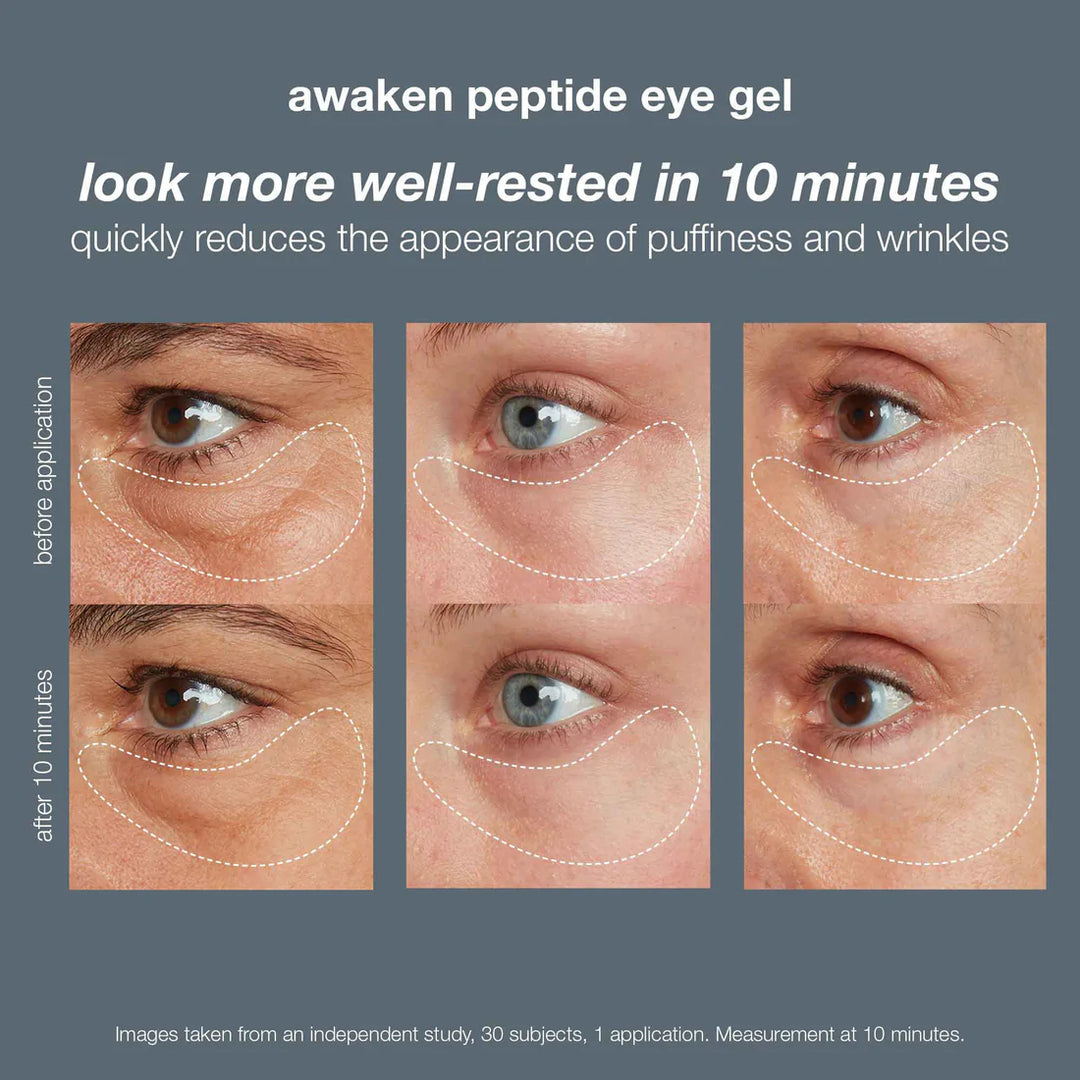 Dermalogica Awaken Peptide Depuffing Eye Gel The Secret Day Spa