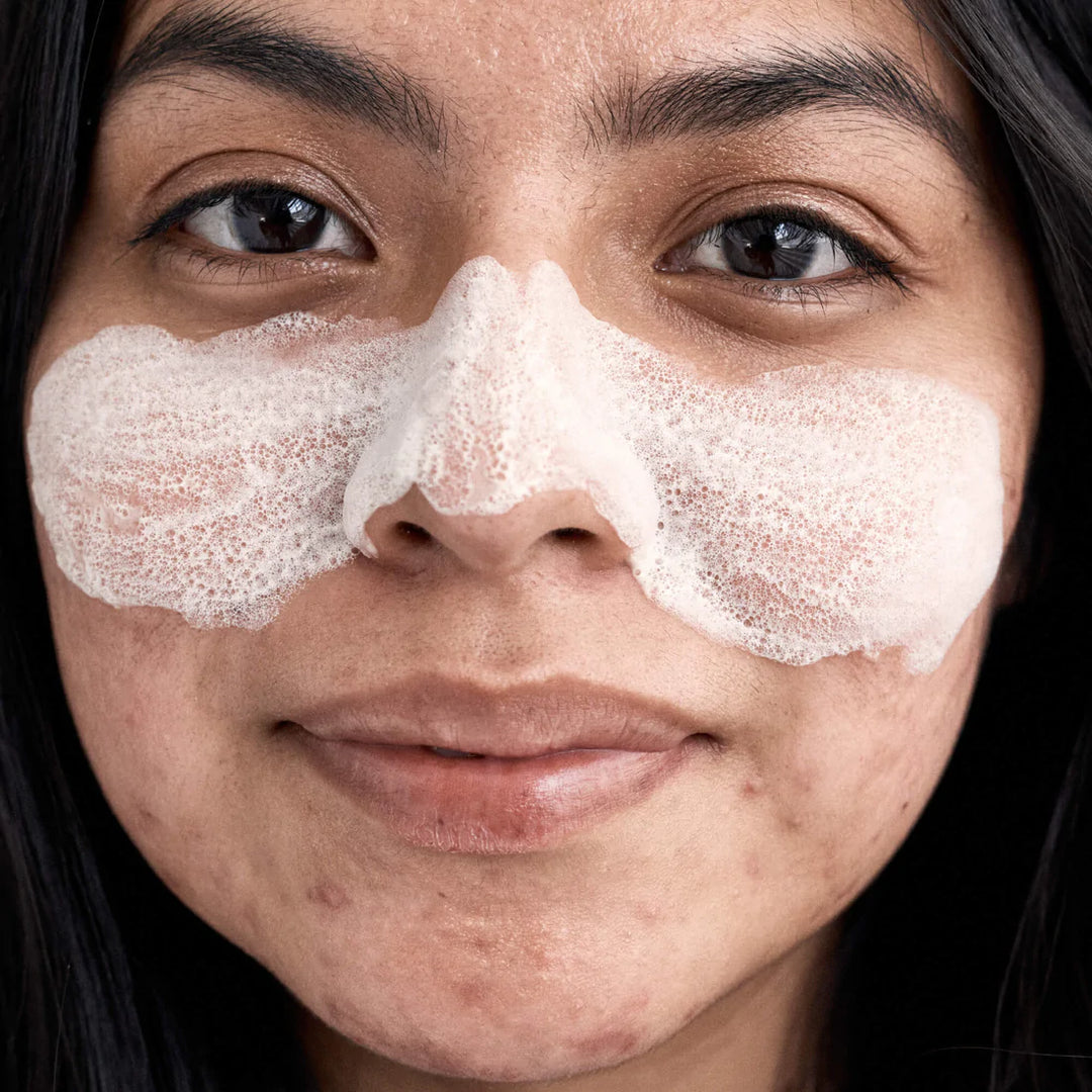 Blackhead skin discount mask